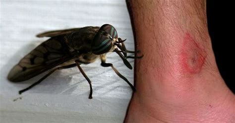 Horsefly Bites How To Tell If Youve Been Bitten And The Best Remedies