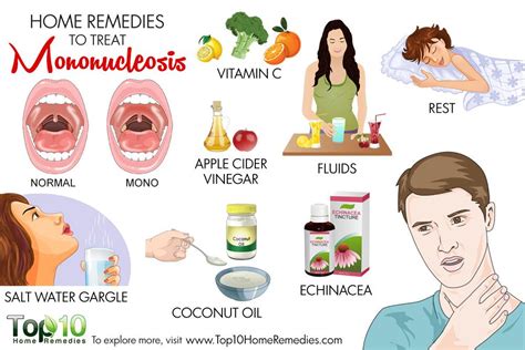 Home Remedies To Treat Mononucleosis Top 10 Home Remedies