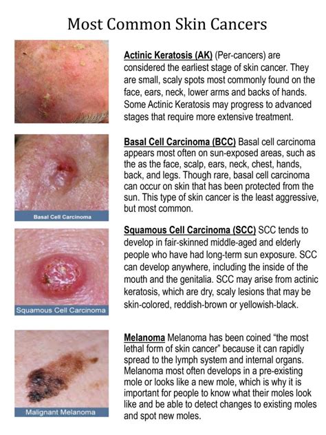 Types Of Skin Cancer Surgery