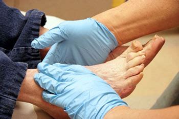 Welcome to podiatry associates of fl. Diabetic Foot Care - Foot Doctor, The Villages, FL