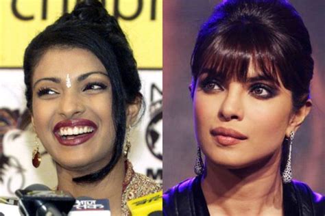 bollywood actresses with plastic surgery filmy keeday