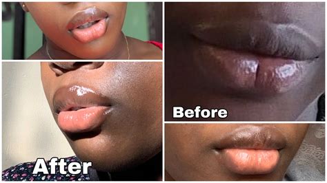 How To Lighten Your Lips Easily At Home In 2020 How To Get A Pink And