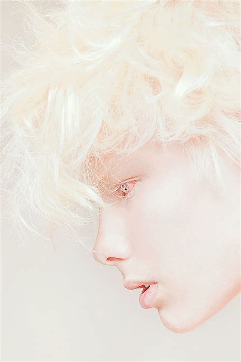 Cream Igor Klepnev The Combination Of Androgyny And Albinism And The