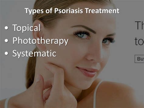 Ppt Information Presentation Of Psoriasis Care Powerpoint