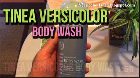Best Body Wash For Tinea Pityriasis Versicolor Youtube