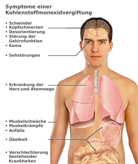 Kohlenmonoxidvergiftung Ursachen Symptome Behandlung