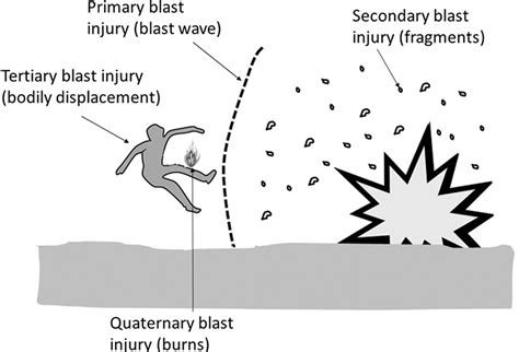 Blast Injury Types Signs Symptoms Diagnosis And Treatment