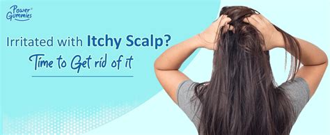 5 Reasons For Your Itchy Scalp Causes And Remedies To Get Relief