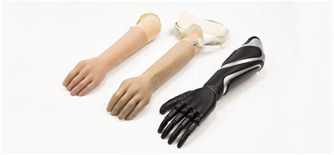 Types Of Upper Extremity Prosthetic Hands
