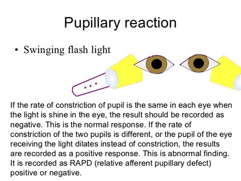 How To Assess Pupillary Reaction Nursing Crib