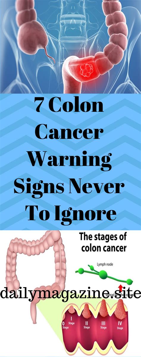 Best Ideas For Coloring Sign Of Colon Cancer