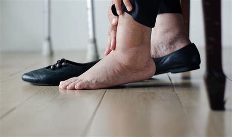 Heart Disease Swollen Ankles Could Be A Warning Of The Life