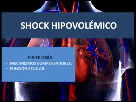 Shock hipovolémico  concepto definición de shock: Shock hipovolémico - Fisiología - YouTube