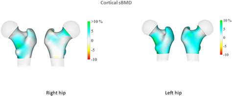 Frontiers Areal Bone Mineral Density Trabecular Bone Score And 3d