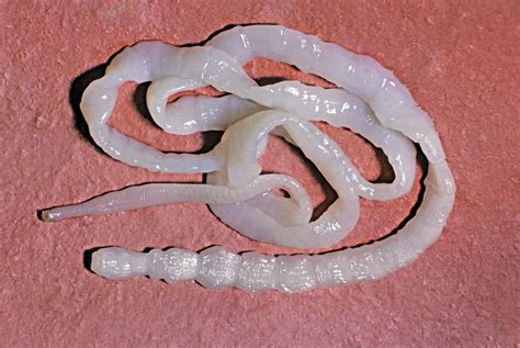 Tapeworm Infestation In A Returned Traveller Gponline