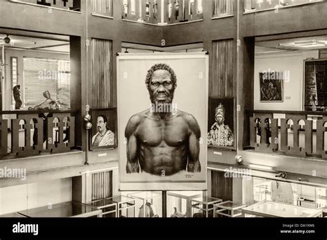 Homo Sapiens Idaltu Ethiopian National Museum Addis Ababa Ethiopia