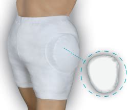 Animation présentant le bas du bassin et les caractéristiques d'une fracture du col du fémur. Sturzprophylaxe, Prévention contre les chutes, propant