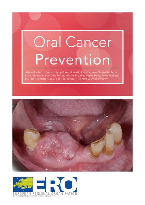 Pdf Oral Cancer Prevention
