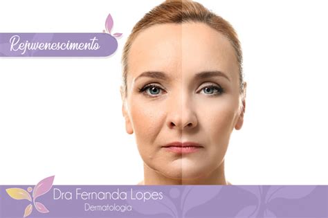 Dra Fernanda Lopes Dermatologia Blog Rejuvenescimento