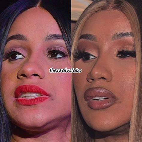 Cardi B Before And After Nose Job And Fillers Celebrity Plastic Surgery Cardi B Photoshop Magazine