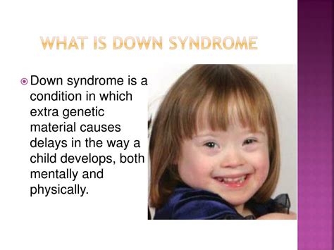 Ppt Down Syndrome Powerpoint Presentation Free Download Id6367487