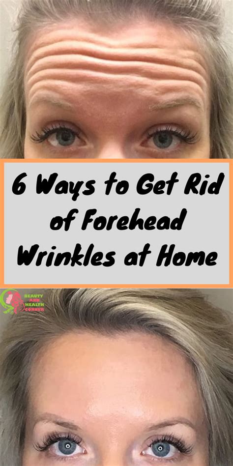 How To Get Rid Of Forehead Wrinkles Forehead Wrinkles Skin Care