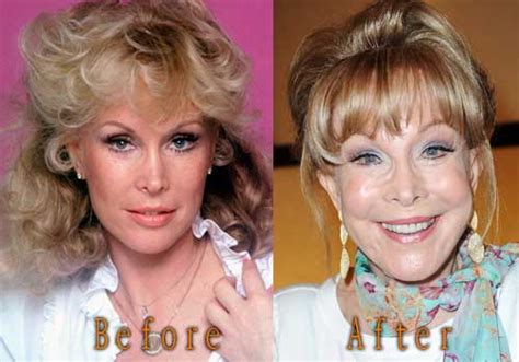 Barbara Eden Plastic Surgery Before And After Top Celebrity Surgery