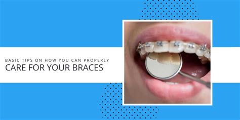 Tips On How You Can Properly Care For Your Braces