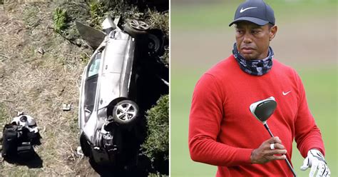 Tiger Woods Hospitalized W Multiple Leg Injuries After Single Car