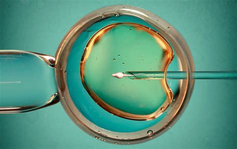 Your Ivf Timeline How Long Does One In Vitro Fertilization Cycle Take Reproductive Medicine