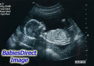 Ultrasound Kidsdirect