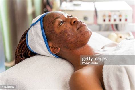 Acne Scars Black Person Photos And Premium High Res Pictures Getty Images