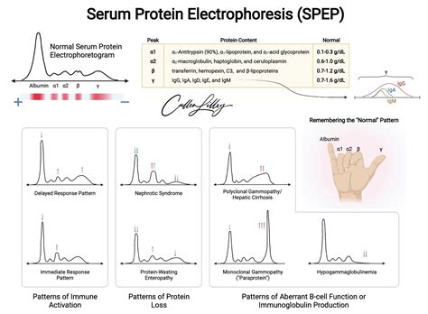 Serum Protein Electrophoresis And Immunofixation Electrophoresis Spep