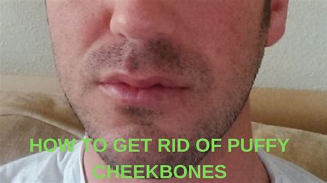 How To Get Rid Of Puffiness On Cheekbones Youtube