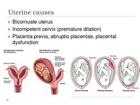 This Is How My Uterus Is Shape No Its Not From Prior C Sections