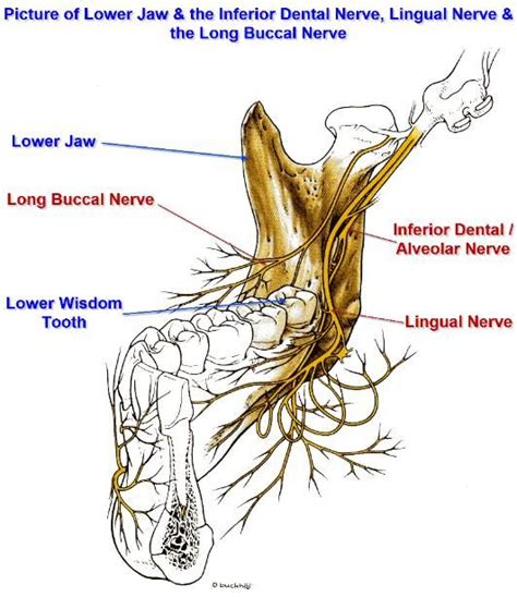 Inferior Dental Alveolar And Lingual Nerve Injuries In 2021 Dental