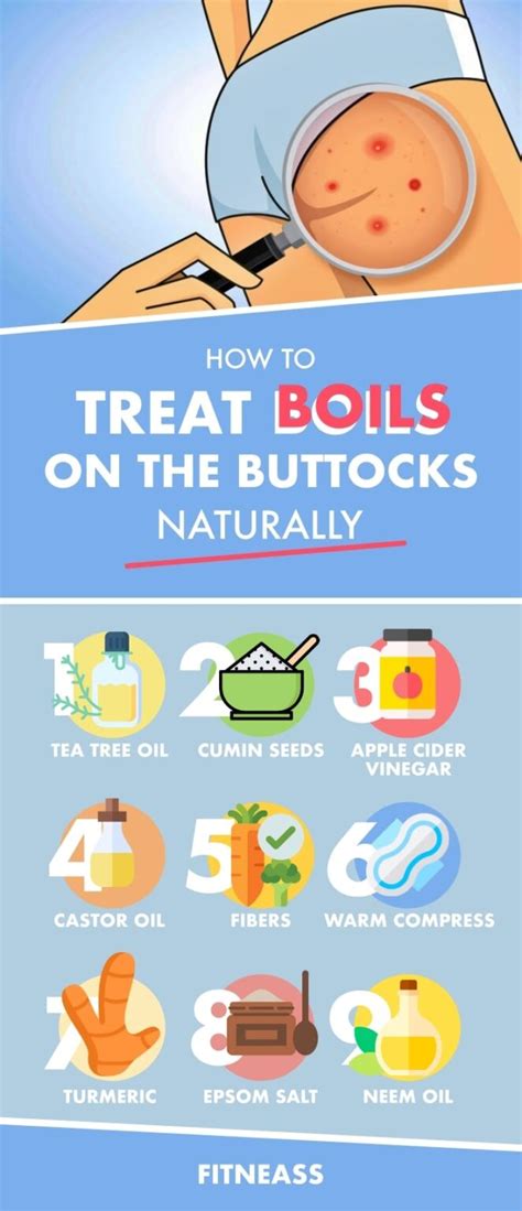 How To Treat Boils On The Buttocks With Natural Remedies
