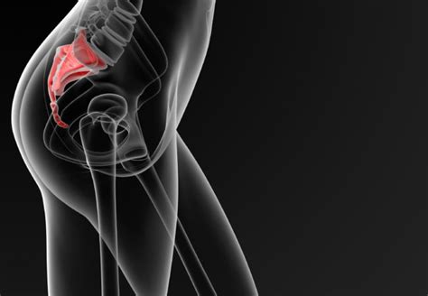 Bone spurs can be difficult to diagnose due to a lack of injury: Can You Actually Break Your Tailbone — Or Only Bruise It ...