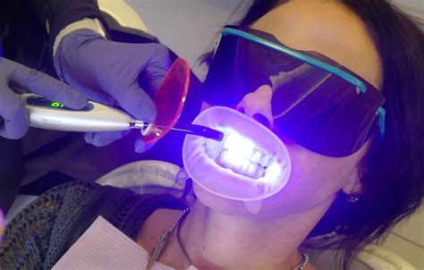 What Is UV Teeth Whitening And Is It Safe