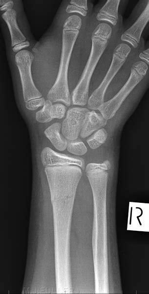 Orthopaedic Clinic Wrist Radiography Wikiradiography