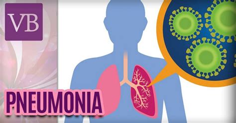 Principais Sintomas Da Pneumonia