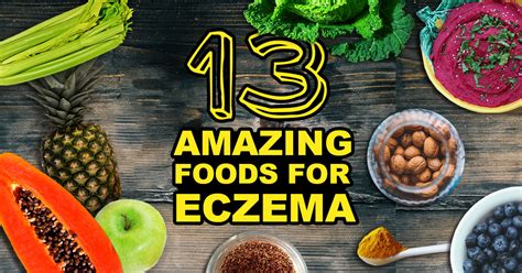 13 Good Foods For Eczema Sufferers