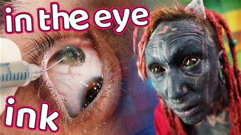 The procedure transformed the whites of their eyes into colored orbs with an otherworldly effect. Eyeball Tattoo - All about eye scleral tattooing + Close ...