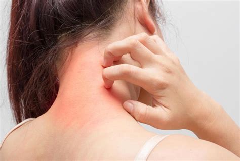 In People With Fibromyalgia Rashes Could Also Occur Findatopdoc