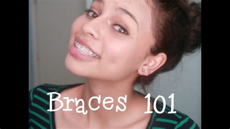 Braces 101 Typescostand How To Get Them Cheap Youtube