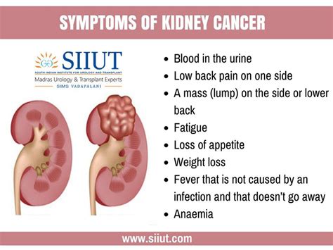 The same symptoms can also come from other causes. Renal cancer urology Revista Urologia » 80 Years of The ...
