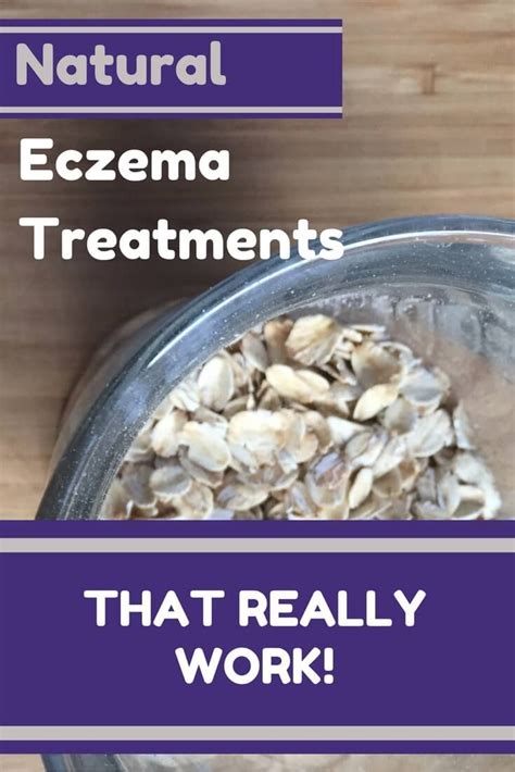 5 Natural Home Remedies For Eczema That Really Work Home Remedies