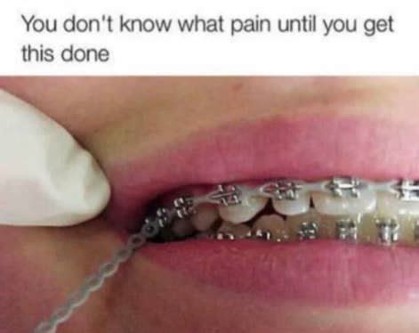 Even though my teeth were straight and pretty, i had to get braces because my bite was off past 3 years i have had this sorted and now have had braces for the past year, i thought that getting my teeth fixed might help the problem but has not. What To Do If Your Teeth Hurt After Tightening Braces ...