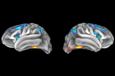 NIH releases data from adolescent brain development study | Health Data 