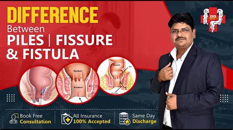 Difference Between Piles Fissure Fistula Piles Fissure Fistula YouTube